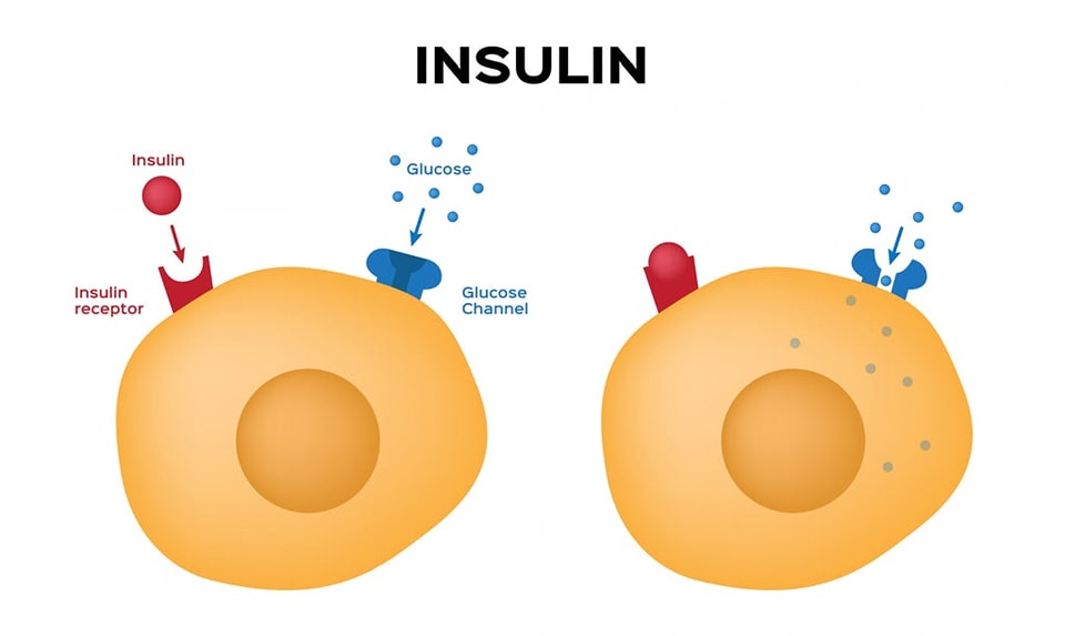 Természetes módszerek az inzulinrezisztencia (IR) ellen